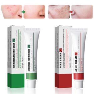 Miioto Whitening Freckle Cream 20g Anti-Pigmentierungscreme, Akne Entfernen, Dark Spot Remover